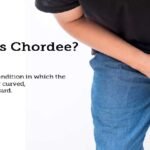 Understanding Chordee Repair: A Comprehensive Guide to Treatment and Recovery