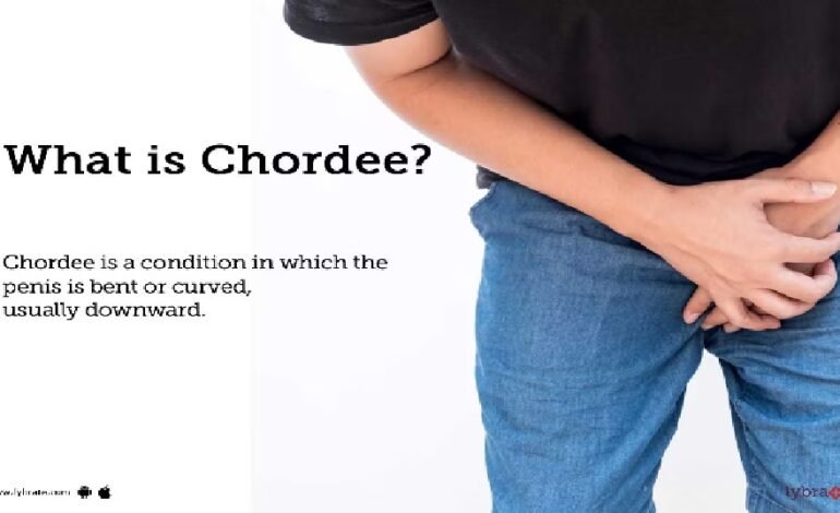 Understanding Chordee Repair: A Comprehensive Guide to Treatment and Recovery